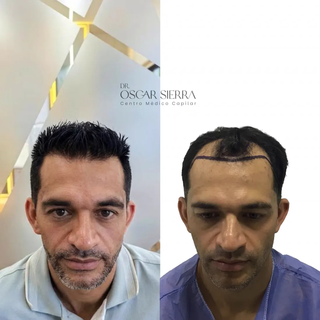 Resultado real de paciente · antes y después