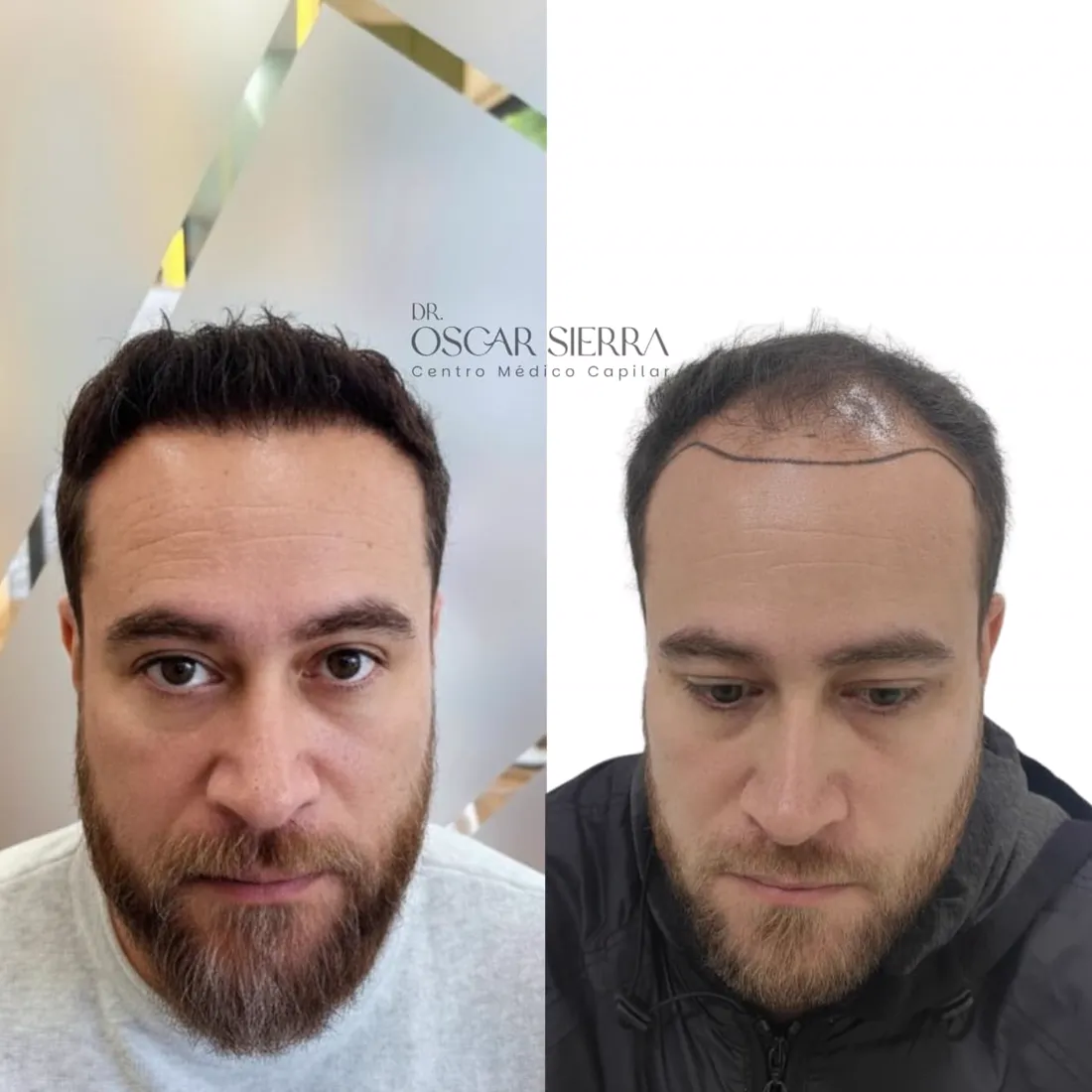 Resultado real de paciente · antes y después
