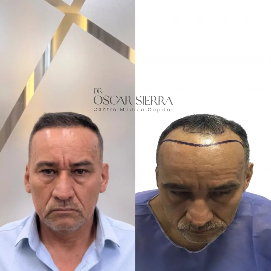 Resultado real de paciente · antes y después