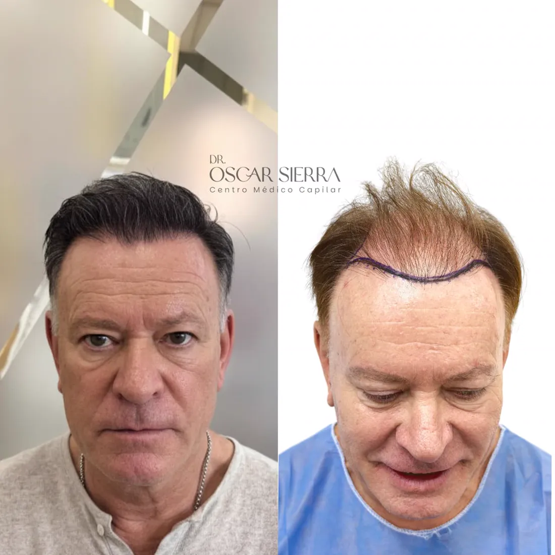 Resultado real de paciente · antes y después