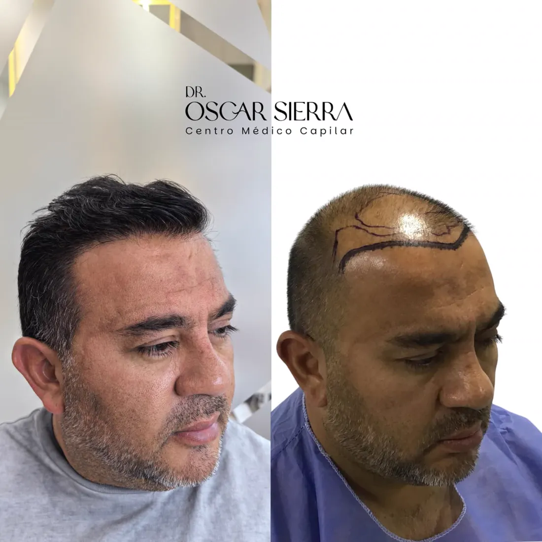 Resultado real de paciente · antes y después