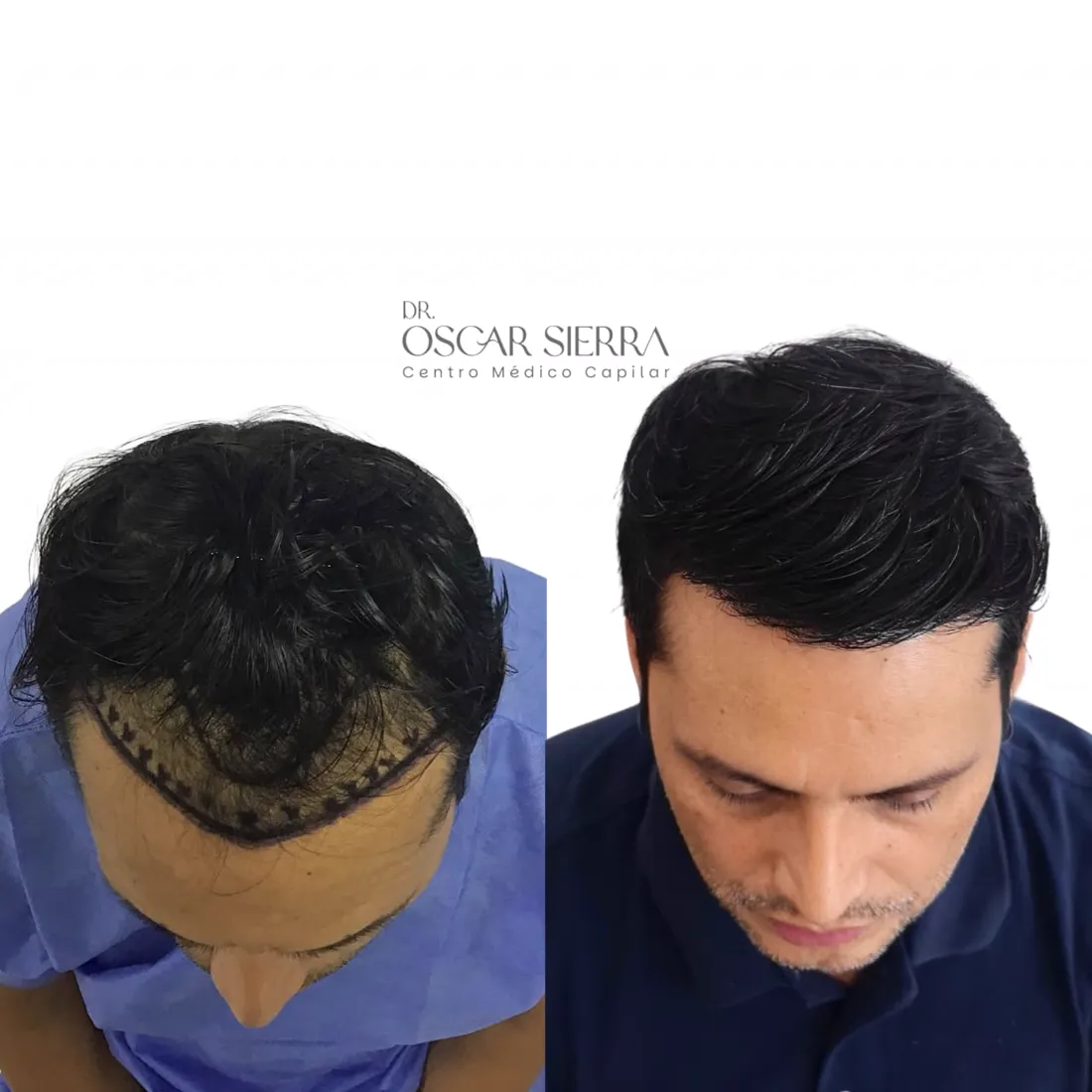 Resultado real de paciente · antes y después