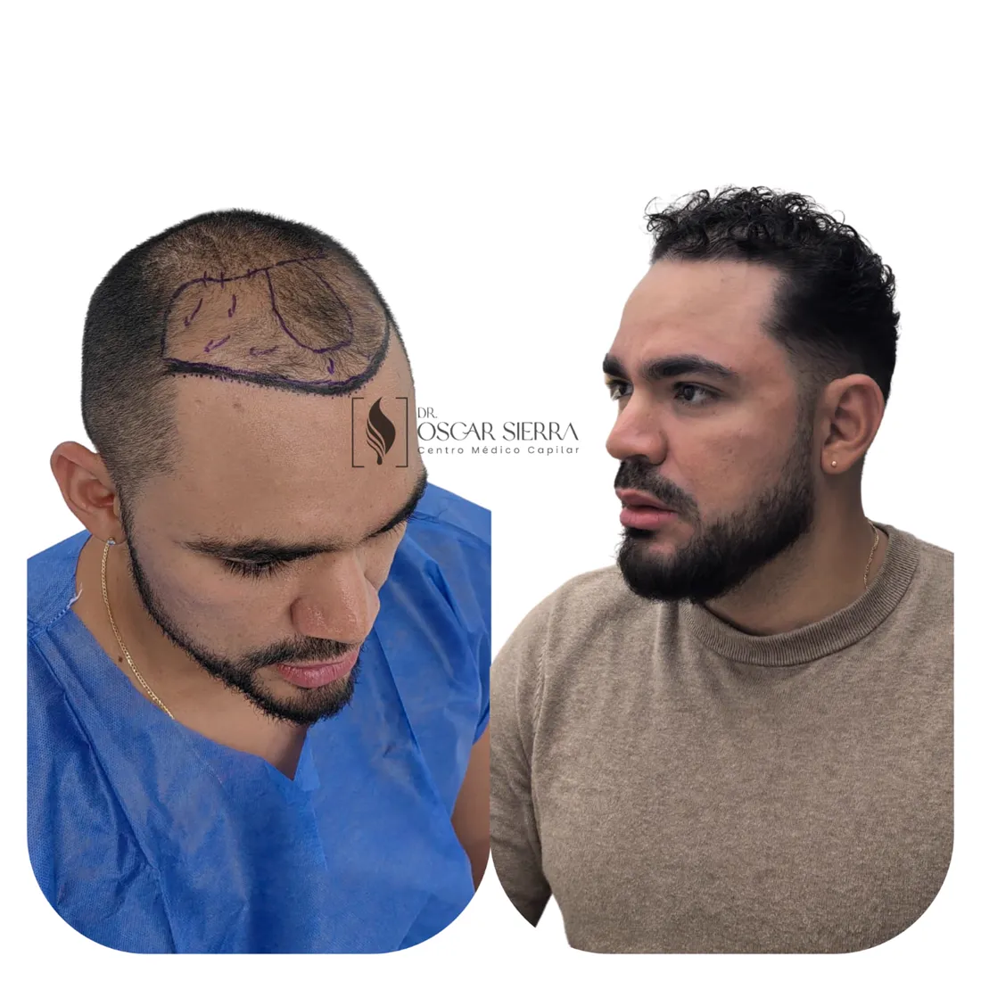 Resultado real de paciente · antes y después