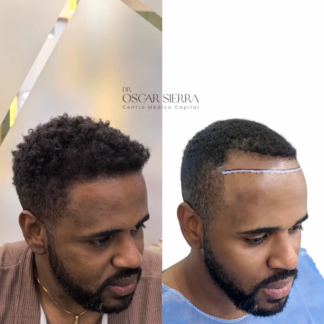 Resultado real de paciente · antes y después